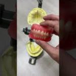 総義歯試適の仕方