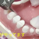 【マンツーマンセミナー受講生・講師比較】模型バージョン：4隅角の丸めと仕上げ形成のタービンの動かし方比較2